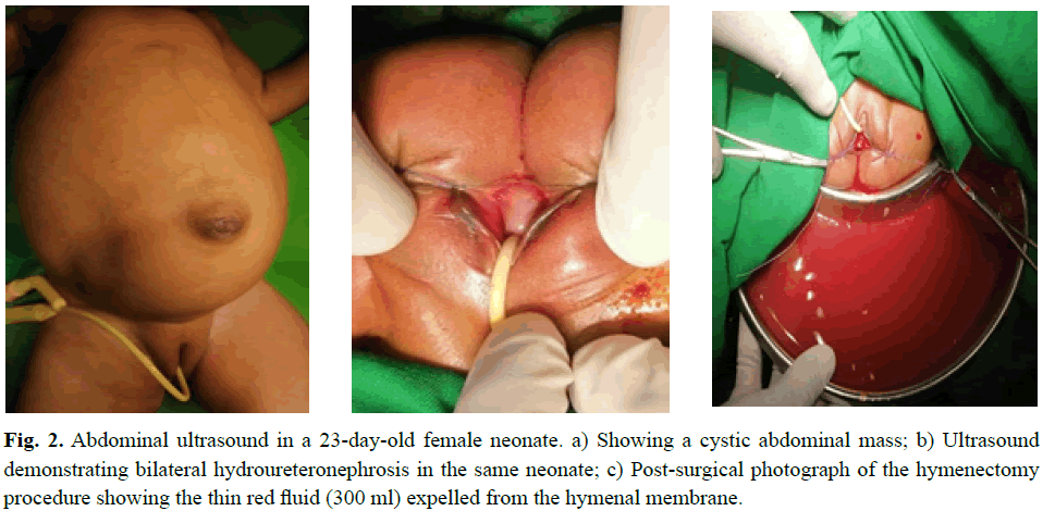 pediatricurology-neonate